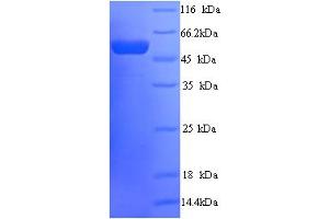 SDS-PAGE (SDS) image for Peter Pan Homolog (PPAN) (AA 1-473), (full length) protein (His tag) (ABIN4975803)