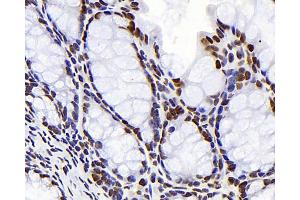 Immunohistochemistry analysis of paraffin-embedded mouse colon using S100A4 Monoclonal Antibody at dilution of 1:300. (s100a4 antibody)