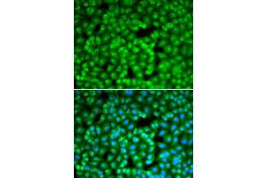 Immunofluorescence analysis of A549 cell using FBL antibody. (Fibrillarin antibody)