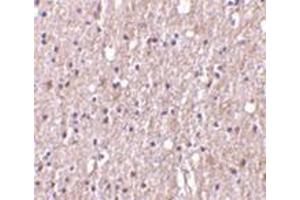 Immunohistochemistry of TWEAK in human brain tissue with this product at 10 μg/ml. (TWEAK antibody)
