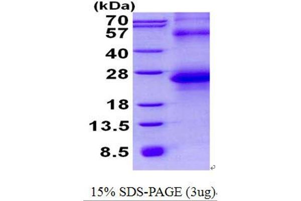 SPINT2 Protein (His tag)