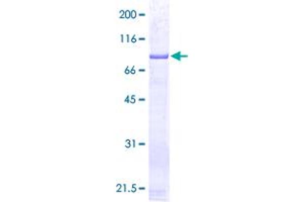 Glutathione Synthetase Protein (GSS) (AA 1-474) (GST tag)