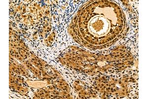 ABIN6262320 and ABIN6268811 at 1/100 staining Rat ovarian tissue by IHC-P.