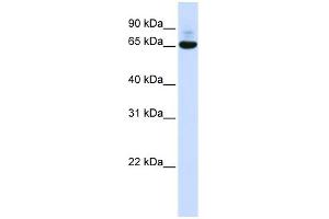 WB Suggested Anti-CNOT4 Antibody Titration:  0. (CNOT4 antibody  (N-Term))