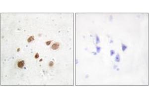 Immunohistochemistry (IHC) image for anti-Pregnancy Up-Regulated Non-Ubiquitously Expressed CaM Kinase (PNCK) (AA 161-210) antibody (ABIN2889644)