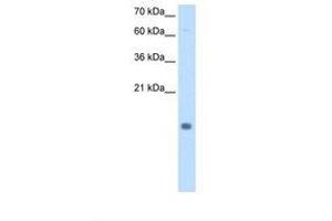 Image no. 1 for anti-Cystatin B (Stefin B) (CSTB) (N-Term) antibody (ABIN6738184) (CSTB antibody  (N-Term))