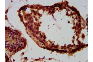 IHC image of ABIN7173930 diluted at 1:300 and staining in paraffin-embedded human testis tissue performed on a Leica BondTM system. (TUSC3 antibody  (AA 42-196))