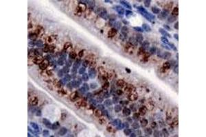 Immunohistochemical staining of TRPA1 on mouse intestine with TRPA1 polyclonal antibody . (TRPA1 antibody  (AA 1-100))
