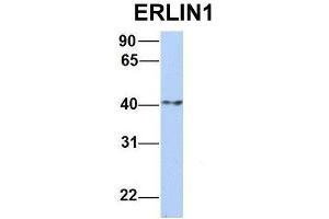 Host:  Rabbit  Target Name:  ERLIN1  Sample Type:  Human MCF7  Antibody Dilution:  1. (ERLIN1 antibody  (N-Term))