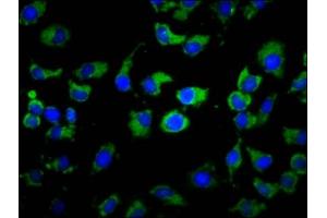 Immunofluorescence staining of A549 cells with ABIN7155184 at 1:133, counter-stained with DAPI. (MS4A2 antibody  (AA 1-59))