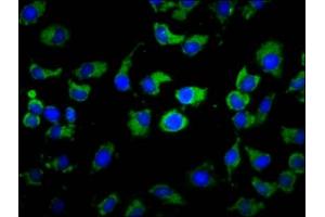 Immunofluorescence staining of A549 cells with ABIN7155184 at 1:133, counter-stained with DAPI. (MS4A2 antibody  (AA 1-59))