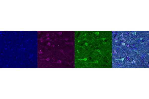 NECAB1 antibody