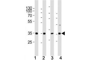 Western blot analysis of lysate from (1) human HeLa cell line, (2) mouse spleen, (3) rat lung, (4) rat stomach tissue using Cyclin D3 antibody at 1:1000. (Cyclin D3 antibody  (AA 33-66))