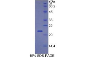 SDS-PAGE analysis of Human CDKN1A Protein.