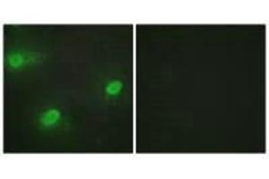 Immunofluorescence analysis of HeLa cells, using CSTF2 antibody. (CSTF2 antibody  (N-Term))