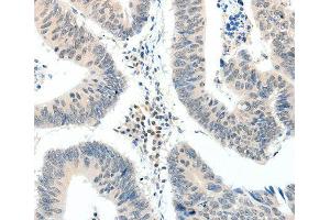 Immunohistochemistry (IHC) image for anti-TNF Receptor-Associated Factor 7 (TRAF7) antibody (ABIN3023478) (TRAF7 antibody)