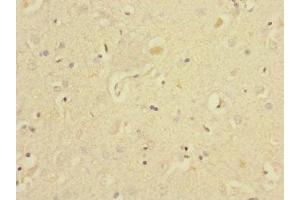 Immunohistochemistry of paraffin-embedded human brain tissue using ABIN7151514 at dilution of 1:100 (EAF2 antibody  (AA 1-170))