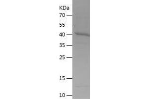 Western Blotting (WB) image for CD86 (CD86) (AA 48-244) protein (His-IF2DI Tag) (ABIN7122216) (CD86 Protein (CD86) (AA 48-244) (His-IF2DI Tag))