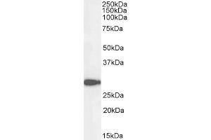 Western Blotting (WB) image for anti-NAD(P)H Dehydrogenase, Quinone 1 (NQO1) (C-Term) antibody (ABIN184714)