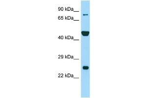 Western Blotting (WB) image for anti-Peptidyl Arginine Deiminase, Type VI (PADI6) (N-Term) antibody (ABIN2790272) (PADI6 antibody  (N-Term))