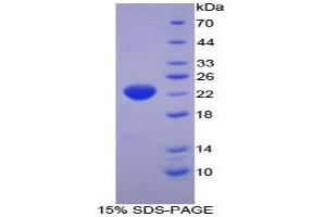 SDS-PAGE analysis of Human HSPb2 Protein. (HSPB2 Protein)