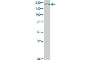 KNTC1 monoclonal antibody (M01), clone 10H4 Western Blot analysis of KNTC1 expression in Hela S3 NE . (KNTC1 antibody  (AA 2100-2209))