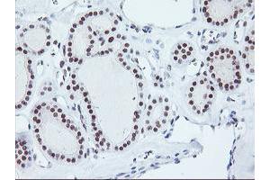 Image no. 5 for anti-Ring Finger Protein 113B (RNF113B) antibody (ABIN1500718) (RNF113B antibody)