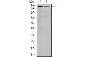 Western blot analysis using ITGA4 mouse mAb against K562(1) and Jurkat (2) cell lysate. (ITGA4 antibody)