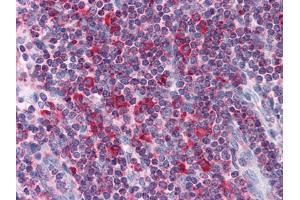Immunohistochemical analysis of paraffin-embedded human Liver tissues using Metadherin mouse mAb (MTDH antibody)
