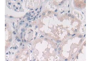 DAB staining on IHC-P; Samples: Human Kidney Tissue (IL-25 antibody  (AA 28-177))