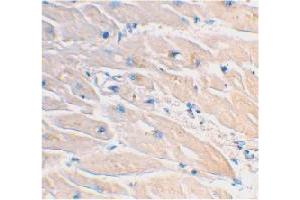 Immunohistochemical staining of human heart tissue using MYD88 polyclonal antibody  at 2 ug/mL . (MYD88 antibody  (AA 233-248))