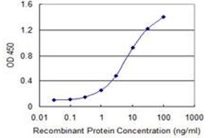 Detection limit for recombinant GST tagged AAK1 is 0. (AAK1 antibody  (AA 315-415))