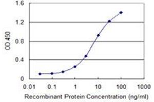 Detection limit for recombinant GST tagged AAK1 is 0. (AAK1 antibody  (AA 315-415))