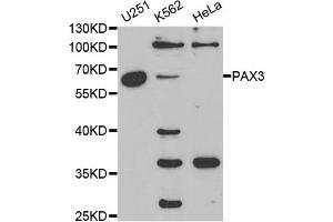 Western blot analysis of extracts of various cell lines, using PAX3 antibody. (Paired Box 3 antibody)