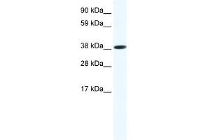 Western Blot showing OBOX6 antibody used at a concentration of 1-2 ug/ml to detect its target protein. (OBOX6 antibody  (Middle Region))