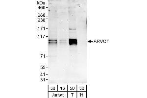 anti-Armadillo Repeat Gene Deleted in Velocardiofacial Syndrome (ARVCF) (AA 75-125) antibody