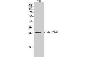 Western Blotting (WB) image for anti-P27 (pThr198) antibody (ABIN3182256) (P27 (pThr198) antibody)