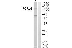 Western blot analysis of extracts from Jurkat cells, using FCRL5 antibody. (FCRL5 antibody  (Internal Region))