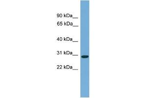 WB Suggested Anti-C20orf201 Antibody Titration: 0. (C20orf201 antibody  (C-Term))
