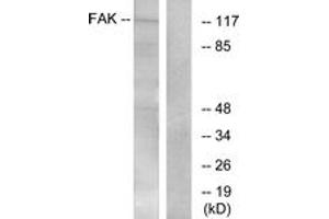 Western Blotting (WB) image for anti-PTK2 Protein tyrosine Kinase 2 (PTK2) (AA 364-413) antibody (ABIN2888988) (FAK antibody  (AA 364-413))