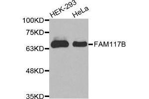 Western Blotting (WB) image for anti-Family with Sequence Similarity 117, Member B (FAM117B) antibody (ABIN1875633) (FAM117B antibody)