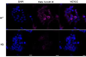 Immunocytochemical staining of Hela cells using Beta Tubulin III antibody (ABIN7800669), 1:1,000), Top panel: wild-type (WT), Bottom panal: Beta Tubulin III shRNA knockdown (KD). (Recombinant TUBB3 antibody)
