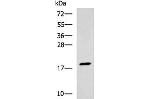 Western blot analysis of Human muscle tissue lysate using TNNC2 Polyclonal Antibody at dilution of 1:400 (TNNC2 antibody)