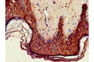 Immunohistochemistry (IHC) image for anti-Glycosylphosphatidylinositol Anchored High Density Lipoprotein Binding Protein 1 (GPIHBP1) (AA 21-151) antibody (ABIN7154234)