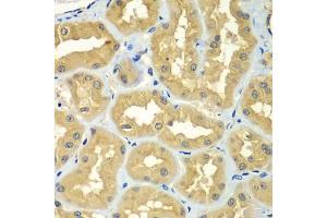 Immunohistochemistry of paraffin-embedded human kidney using GOPC antibody (ABIN6292960) at dilution of 1:100 (40x lens).