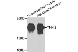 Western blot analysis of extracts of various cells, using TNNI2 antibody. (TNNI2 antibody)