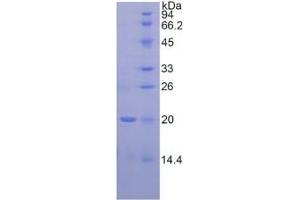 SDS-PAGE (SDS) image for serpin Peptidase Inhibitor, Clade A (Alpha-1 Antiproteinase, Antitrypsin), Member 6 (SERPINA6) ELISA Kit (ABIN6574263)