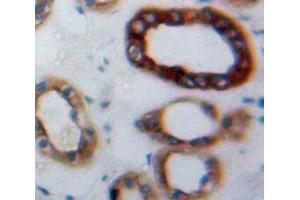 Used in DAB staining on fromalin fixed paraffin-embedded Kidney tissue (HBEGF antibody  (AA 25-160))