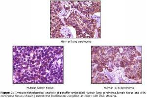 Image no. 1 for anti-B Lymphoid Tyrosine Kinase (BLK) antibody (ABIN232111) (BLK antibody)
