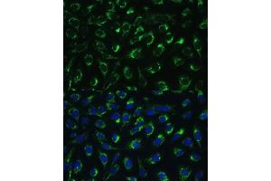 Immunofluorescence (IF) image for anti-Mitochondrial Translational Initiation Factor 2 (MTIF2) (AA 428-727) antibody (ABIN7268591)